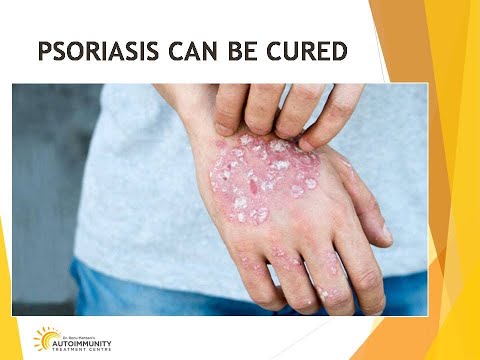 Embedded thumbnail for PSORIASIS CAN BE CURED: VITAMIN D MEGATHERAPY &amp;amp; OZONE THERAPY - PSORIASIS DAY 2021